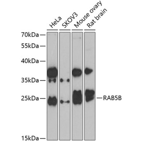 RAB5B Rabbit pAb