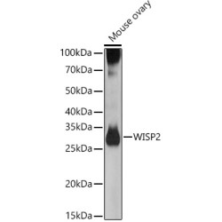 WISP2 Rabbit pAb