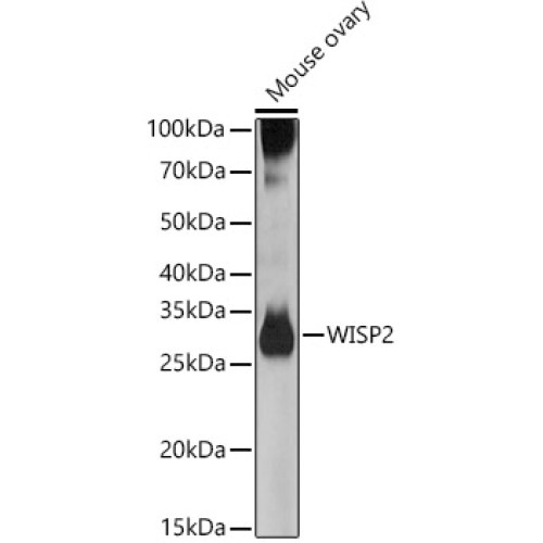 WISP2 Rabbit pAb