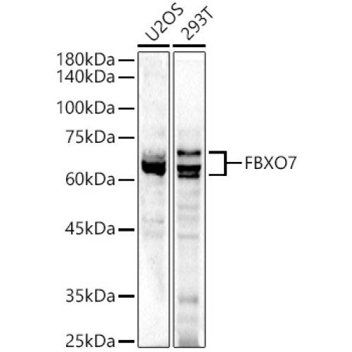 FBXO7 Rabbit pAb