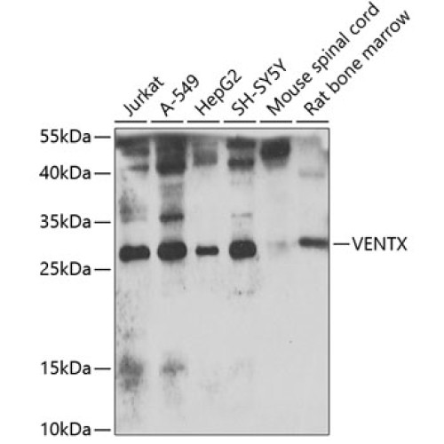 VENTX Rabbit pAb