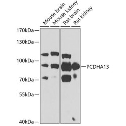 PCDHA13 Rabbit pAb