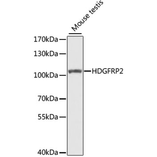 HDGFRP2 Rabbit pAb