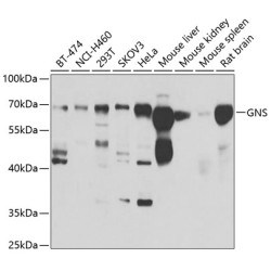 GNS Rabbit pAb