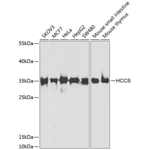HCCS Rabbit pAb