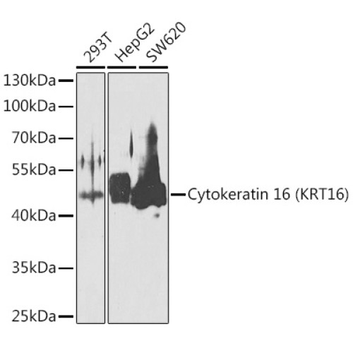 Cytokeratin 16 (KRT16) Rabbit pAb