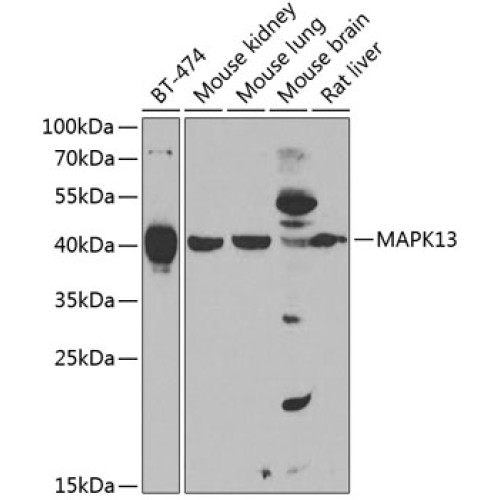 MAPK13 Rabbit pAb