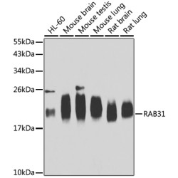 RAB31 Rabbit pAb