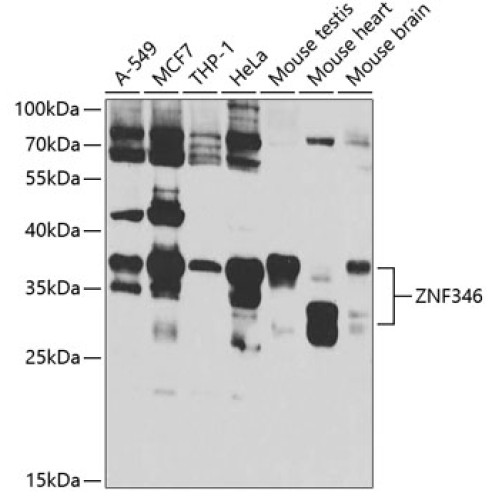 ZNF346 Rabbit pAb