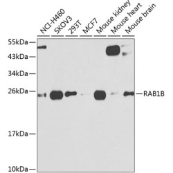 [KO Validated] RAB1B Rabbit pAb