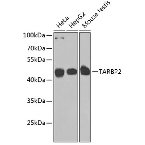 TARBP2 Rabbit pAb