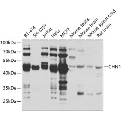 CHN1 Rabbit pAb