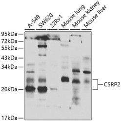 CSRP2 Rabbit pAb