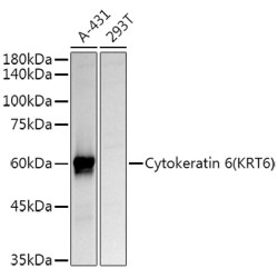Cytokeratin 6 (KRT6) Rabbit pAb