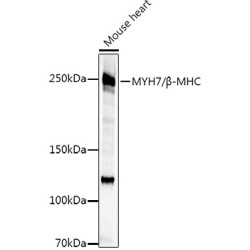 MYH7/β-MHC Rabbit pAb