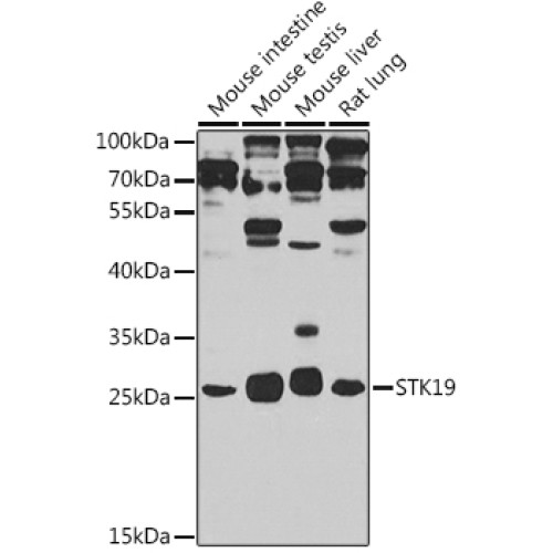STK19 Rabbit pAb