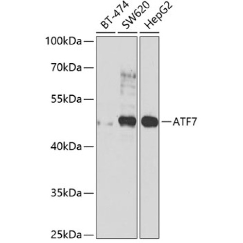 ATF7 Rabbit pAb