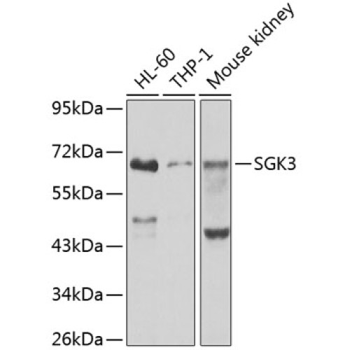 SGK3 Rabbit pAb