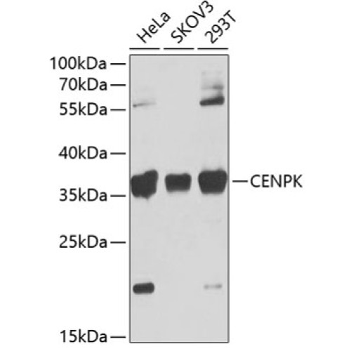 CENPK Rabbit pAb
