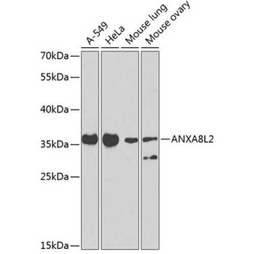 ANXA8L2 Rabbit pAb