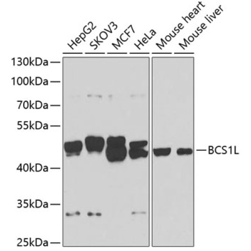 BCS1L Rabbit pAb