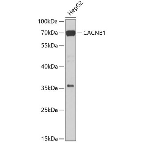 CACNB1 Rabbit pAb