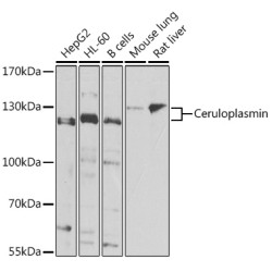 Ceruloplasmin Rabbit pAb