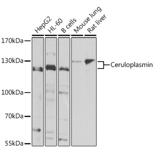 Ceruloplasmin Rabbit pAb