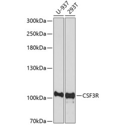 CSF3R Rabbit pAb