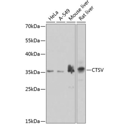 CTSV Rabbit pAb