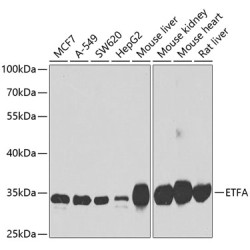 ETFA Rabbit pAb