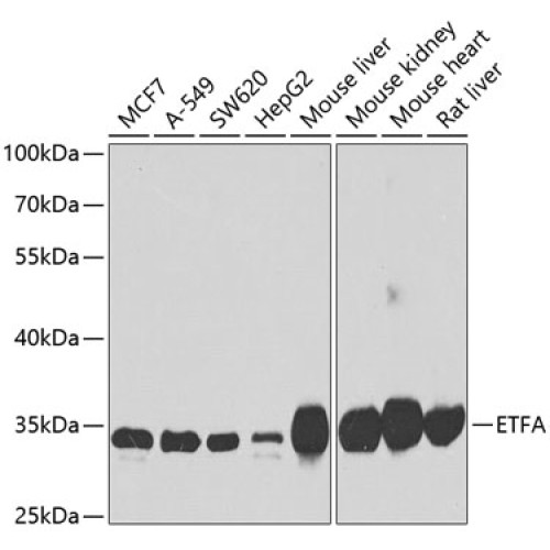 ETFA Rabbit pAb