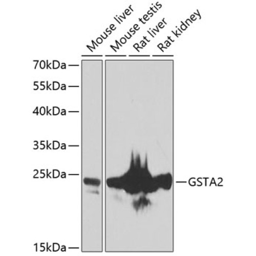 GSTA2 Rabbit pAb
