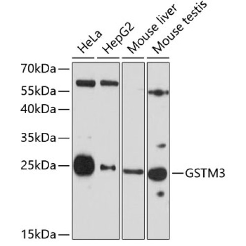 GSTM3 Rabbit pAb