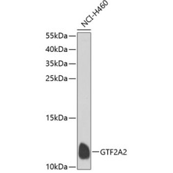 GTF2A2 Rabbit pAb