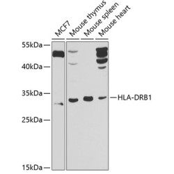 HLA-DRB1 Rabbit pAb