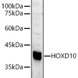 HOXD10 Rabbit pAb