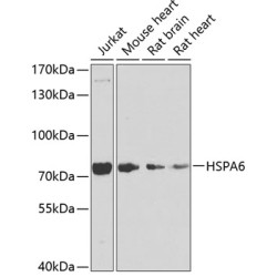 HSPA6 Rabbit pAb