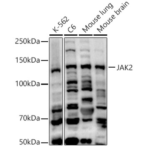 [KO Validated] JAK2 Rabbit pAb