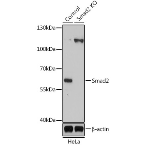 [KO Validated] Smad2 Rabbit pAb