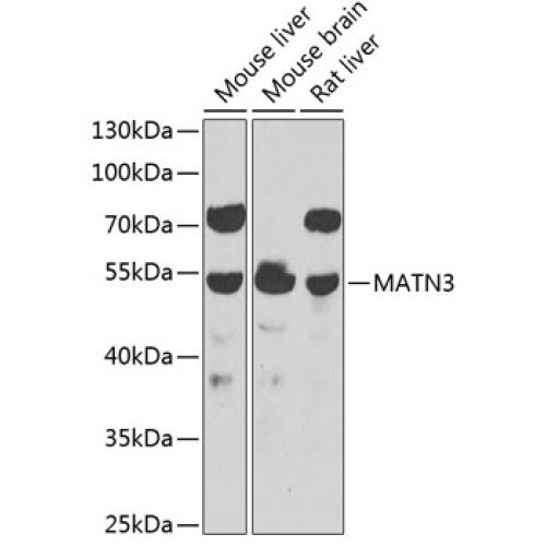 MATN3 Rabbit pAb