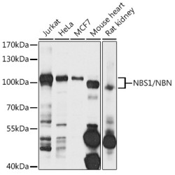 NBS1/NBN Rabbit pAb