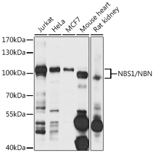 NBS1/NBN Rabbit pAb