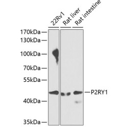 P2RY1 Rabbit pAb