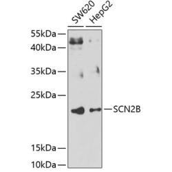 SCN2B Rabbit pAb