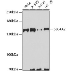 SLC4A2 Rabbit pAb