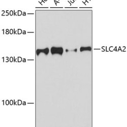 SLC4A2 Rabbit pAb