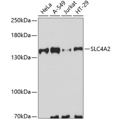 SLC4A2 Rabbit pAb