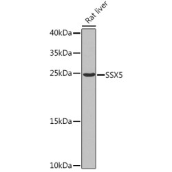 SSX5 Rabbit pAb