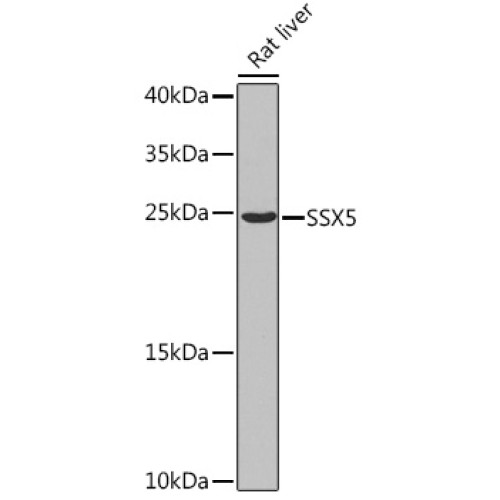 SSX5 Rabbit pAb